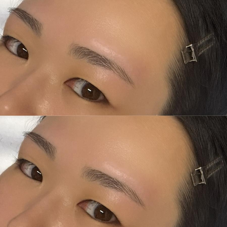 MAHIROのデザイン事例 1（上：施術前／下：施術後）