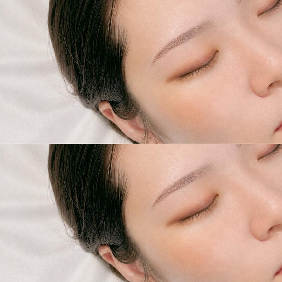MARIKOのデザイン事例 1（上：施術前／下：施術後）