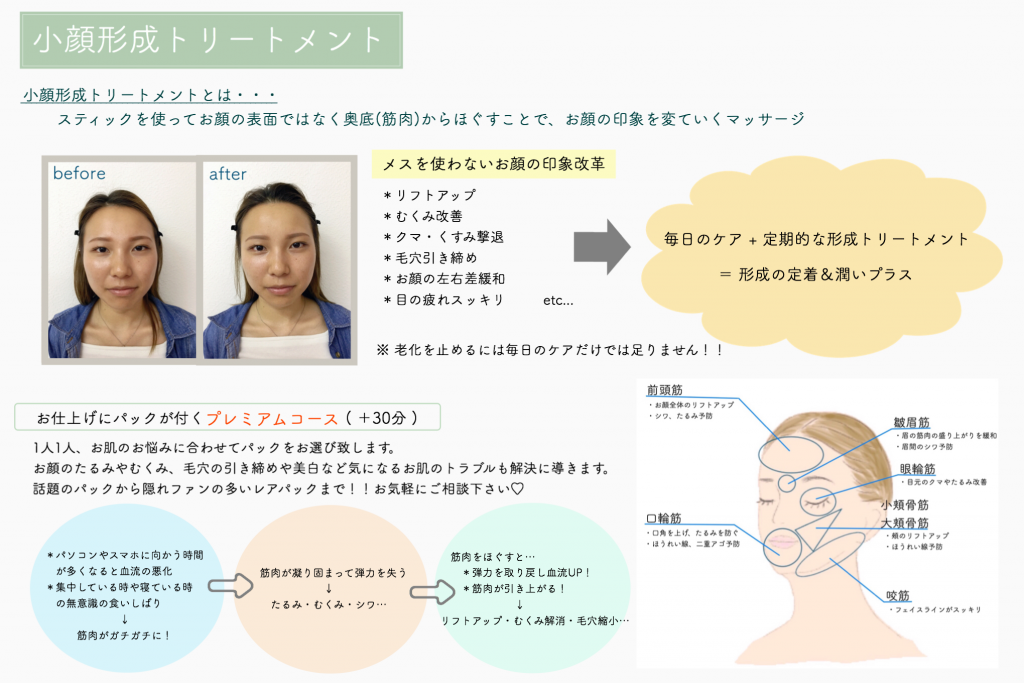 画像に alt 属性が指定されていません。ファイル名: C6DF5493-7D25-4487-BCAC-0A4D3765779B-1024x683.png